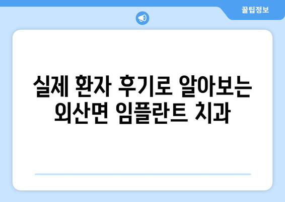 충청남도 부여군 외산면 임플란트 치과 추천 저렴한 곳 잘하는 곳 가격 | 후기 | 비용